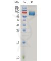 sp-pme100959 ifnar2 sp1