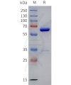 sp-pme100963 igfbp2 sp1