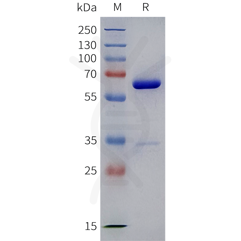 pme100963-igfbp2-sp1.png