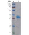 sp-pme100972 lgals3 sp1