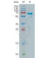 sp-pme100981 mmp2 sp1