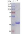 sp-pme101015 tgfb2 sp1
