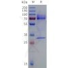 sp-pme101016 tgfb3 sp1
