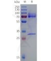 sp-pme101016 tgfb3 sp1