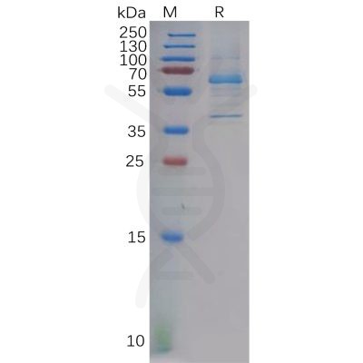 sp-pme101042 dkk2 sp1