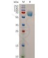 sp-pme101058 ifngr1 sp1