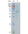 sp-pme101060 cxcl13 sp1