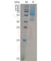 sp-pme101076 gpc1 sp1