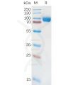 sp-pme101079 il18ra sp1