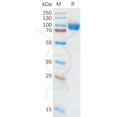 sp-pme101079 il18ra sp1
