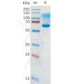 sp-pme101085 cd43 sp1