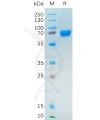sp-pme101093 nrg1 sp1
