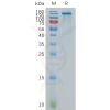 sp-pme101100 enpp3 sp1
