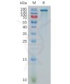 sp-pme101100 enpp3 sp1