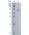 sp-pme101105 ccr6 sp1