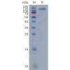 sp-pme101115 osmr sp1
