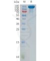 sp-pme101122 ptprg sp1