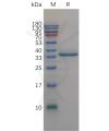 sp-pme101125 igfbp2 sp1