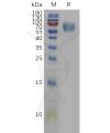 sp-pme101126 il18bp sp1