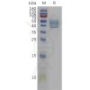 sp-pme101128 il13 sp1