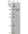 sp-pme101133 il12b sp1
