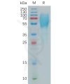 sp-pme101143 lamp3 sp1