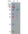 sp-pme101146 s protein rbd sp1