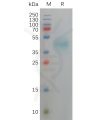 sp-pme101147 dlk1 sp1