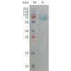 sp-pme101149 fgfr3 sp1