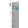 sp-pme101150 ceacam8 sp1