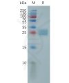 sp-pme101154 ulbp2 sp1