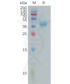 sp-pme101157 pttg1ip sp1
