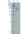 sp-pme101163 lrg1 sp1