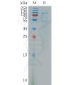 sp-pme101170 cdh11 sp1