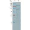 sp-pme101171 cdh11 sp1
