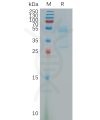 sp-pme101174 msmp sp1