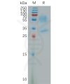 sp-pme101175 prokr1 sp1