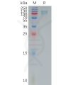 sp-pme101178 postn sp1