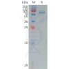 sp-pme101180 fzd7 sp1