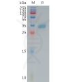 sp-pme101184 cldn4 sp1