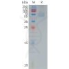 sp-pme101185 trpv1 sp1