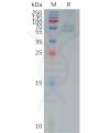 sp-pme101185 trpv1 sp1