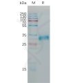 sp-pme101189 cldn6 sp1