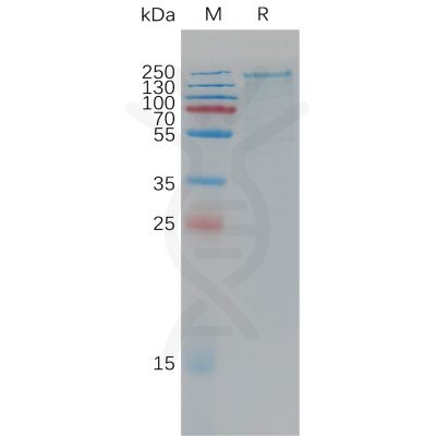 sp-pme101193 lrp6 sp1