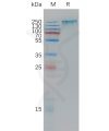 sp-pme101194 sez6 sp1