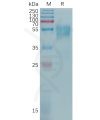 sp-pme101201 cd55 sp1