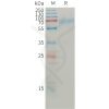 sp-pme101211 angpt2 sp1