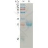 sp-pme101212 angpt2 sp1