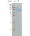 sp-pme101215 selenop sp1