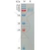 sp-pme101220 plxdc2 sp1